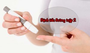 Tiểu đường type 2