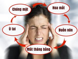 Rối loạn tiền đình